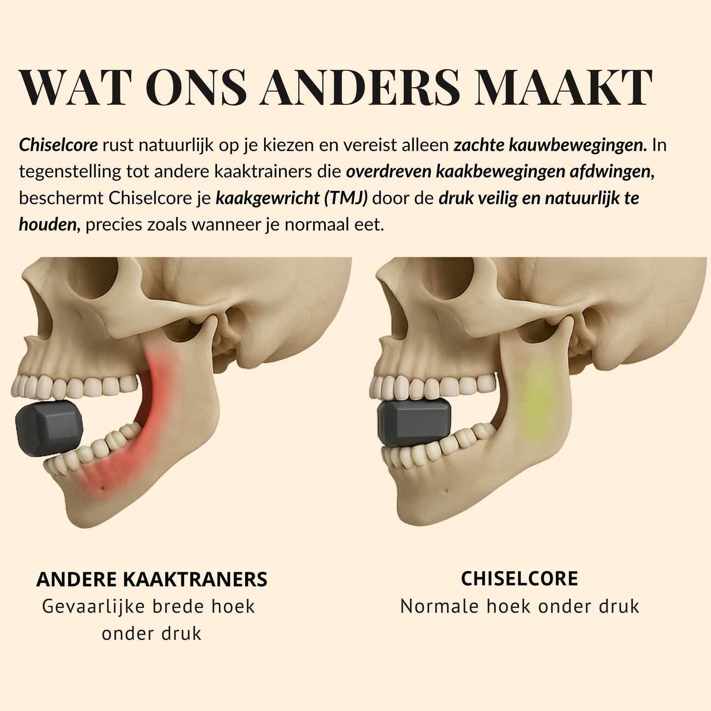 LineLift Jaw Trainer - By Laurain