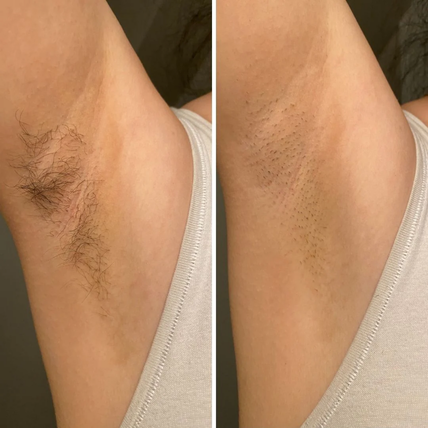 SmoothSilk Precision Trimmer - By Laurain