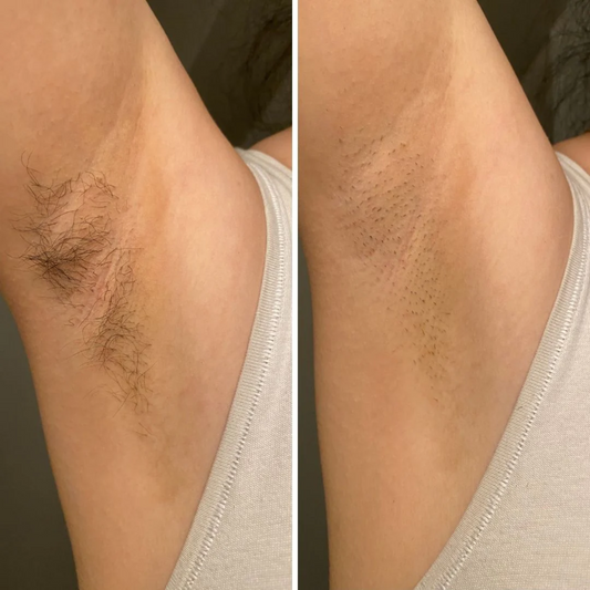 SmoothSilk Precision Trimmer - By Laurain