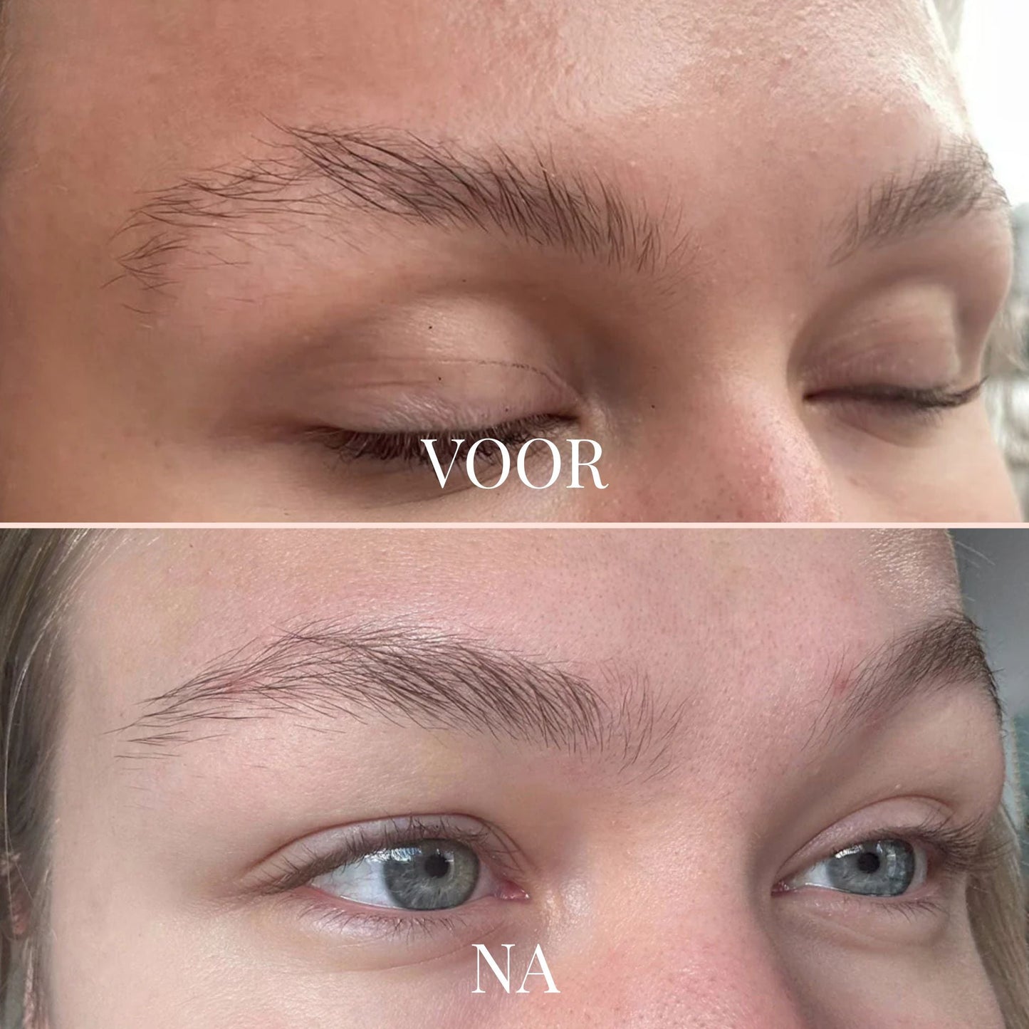 FullLine Boost Roller - By Laurain