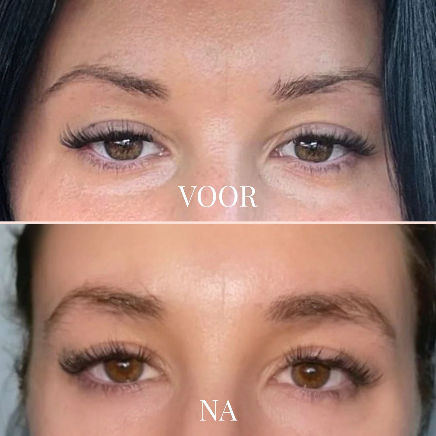 FullLine Boost Roller - By Laurain