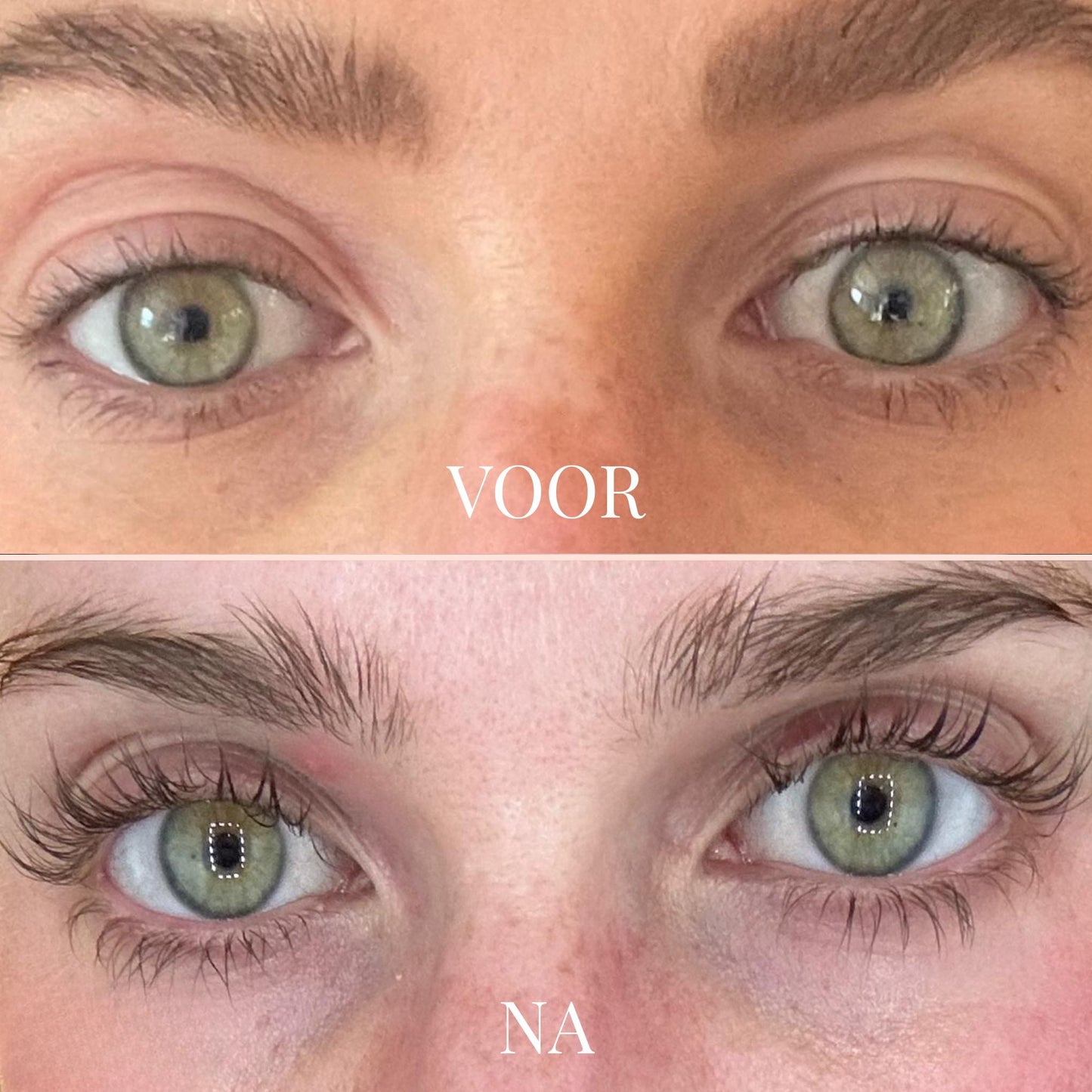 FullLine Boost Roller - By Laurain