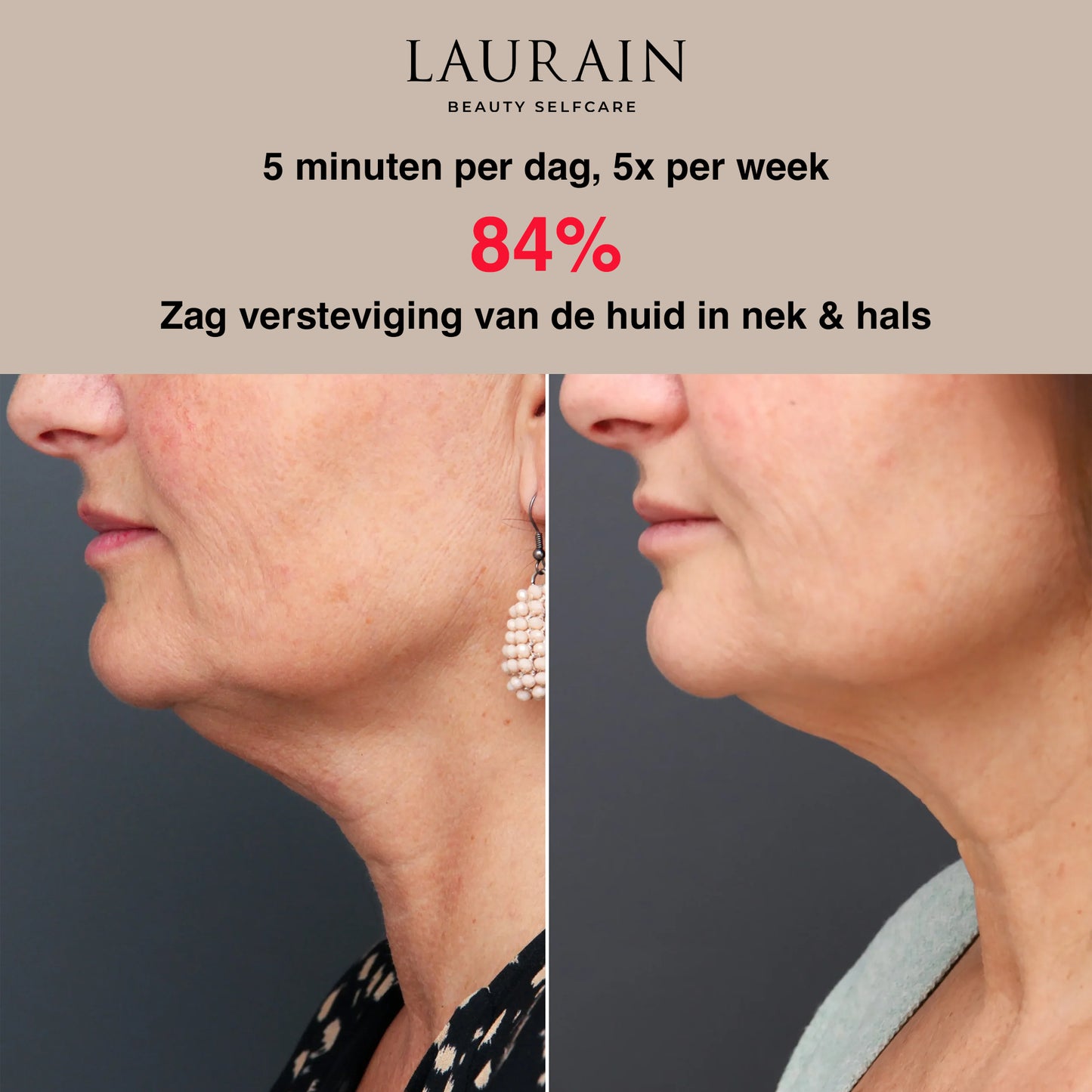 SkinLift Pro - By Laurain