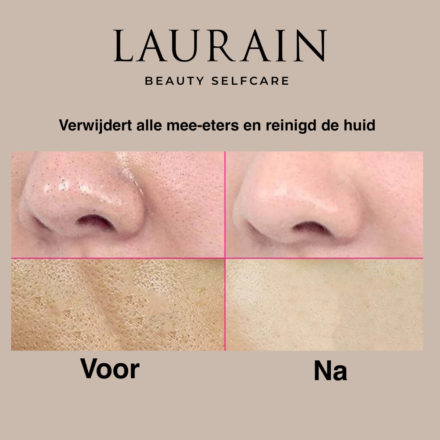 DeepClean Skin Scrubber - By Laurain